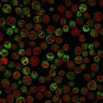 CD79a (B-Cell Marker) Monoclonal Antibody (HM57)