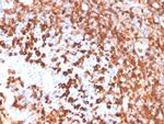 CD79a Antibody in Immunohistochemistry (Paraffin) (IHC (P))