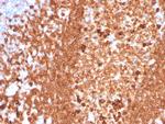 CD79a Antibody in Immunohistochemistry (Paraffin) (IHC (P))