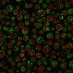 CD79a Recombinant Rabbit Monoclonal Antibody (IGA, 1688R)