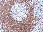 CD79a (B-Cell Marker) Antibody in Immunohistochemistry (Paraffin) (IHC (P))