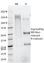 CD79b (B-Cell Marker) Antibody in SDS-PAGE (SDS-PAGE)