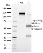 CD79b Antibody in SDS-PAGE (SDS-PAGE)