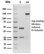 CD79b (B-Cell Marker) Monoclonal Antibody (rIGB/1842)