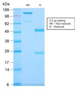 CD79b (B-Cell Marker) Recombinant Rabbit Monoclonal Antibody (IGB/2940R)