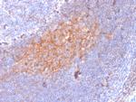 CD81/TAPA-1 Monoclonal Antibody (1.3.3.22)