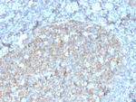 CD81/TAPA-1 Recombinant Mouse Monoclonal Antibody (rC81, 3442)