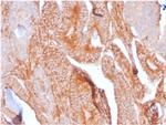 CD81/TAPA-1 Recombinant Rabbit Monoclonal Antibody (C81, 2885R)
