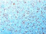 Cdk1/p34cdc2 Antibody in Immunohistochemistry (Paraffin) (IHC (P))