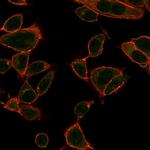 ZBTB39/ZNF922/KIAA0352 Monoclonal Antibody (PCRP-ZBTB39-1A11)