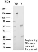 Synaptic Vesicle Protein 2 (SV2) (Marker of Neuroendocrine Cells) Antibody in SDS-PAGE (SDS-PAGE)