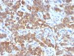 TNFS15/VEGI (Vascular Endothelial Growth Inhibitor) Monoclonal Antibody (VEGI/1283)