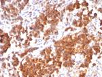 TNFS15/VEGI (Vascular Endothelial Growth Inhibitor) Recombinant Mouse Monoclonal Antibody (rVEGI, 1283)