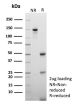 TNFS15/VEGI (Vascular Endothelial Growth Inhibitor) Antibody in SDS-PAGE (SDS-PAGE)