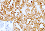 TNFS15/VEGI (Vascular Endothelial Growth Inhibitor) Antibody in Immunohistochemistry (Paraffin) (IHC (P))