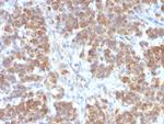 TNFS15/VEGI (Vascular Endothelial Growth Inhibitor) Recombinant Rabbit Monoclonal Antibody (VEGI, 2052R)