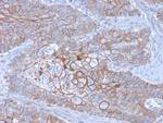 E-Cadherin (CDH1)/CD324 (Intercellular Junction Marker) Antibody in Immunohistochemistry (Paraffin) (IHC (P))
