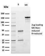 E-Cadherin (CDH1)/CD324 (Intercellular Junction Marker) Antibody in SDS-PAGE (SDS-PAGE)