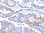 E-Cadherin/ CD324 (Intercellular Junction Marker) Antibody in Immunohistochemistry (Paraffin) (IHC (P))
