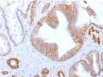 E-Cadherin/ CD324 (Intercellular Junction Marker) Antibody in Immunohistochemistry (Paraffin) (IHC (P))
