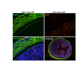 Rabbit IgG (H+L) Highly Cross-Adsorbed Secondary Antibody in Immunohistochemistry (Paraffin) (IHC (P))