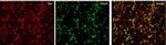 Rabbit IgG (H+L) Highly Cross-Adsorbed Secondary Antibody in Immunocytochemistry (ICC/IF)