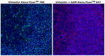 Mouse IgG1 Cross-Adsorbed Secondary Antibody in Immunohistochemistry (Paraffin) (IHC (P))
