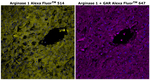 Mouse IgG1 Cross-Adsorbed Secondary Antibody in Immunohistochemistry (Paraffin) (IHC (P))