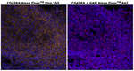 Mouse IgG2b Cross-Adsorbed Secondary Antibody in Immunohistochemistry (Paraffin) (IHC (P))
