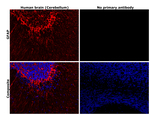 GFAP Antibody in Immunohistochemistry (Paraffin) (IHC (P))