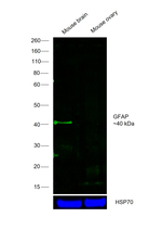 GFAP Antibody