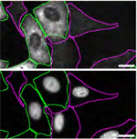 Goat anti-Rabbit IgG (H+L) Highly Cross-Adsorbed Secondary Antibody, Alexa Fluor™ 555