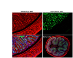 Rat IgG (H+L) Cross-Adsorbed Secondary Antibody in Immunohistochemistry (Paraffin) (IHC (P))