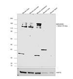 NMDAR2B Polyclonal Antibody