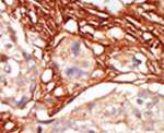 A-Raf Antibody in Immunohistochemistry (IHC)