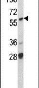 A-Raf Antibody in Western Blot (WB)