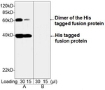 His Tag Antibody in Western Blot (WB)