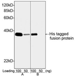 His Tag Antibody in Western Blot (WB)