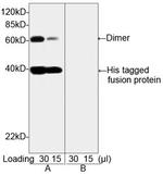 His Tag Antibody in Western Blot (WB)