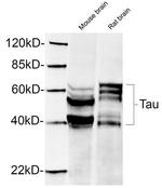 Phospho-Tau (Ser396) Antibody in Western Blot (WB)