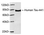 Phospho-Tau (Ser396) Antibody in Western Blot (WB)