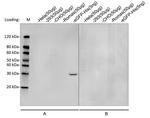 His Tag (C-term) Antibody in Western Blot (WB)