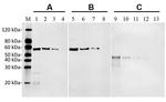 DYKDDDDK Tag Antibody in Western Blot (WB)