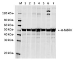 SpCas9 Antibody in Western Blot (WB)