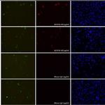 SpCas9 Antibody in Immunocytochemistry (ICC/IF)