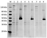 SpCas9 Antibody in Western Blot (WB)