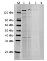 SpCas9 Antibody in Western Blot (WB)