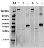 SpCas9 Antibody in Western Blot (WB)