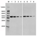 SpCas9 Antibody in Western Blot (WB)