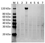 SaCas9 Antibody in Western Blot (WB)